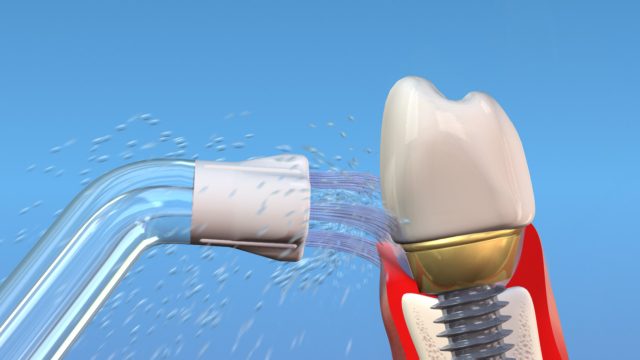 Đầu xịt Plaque Seeker Waterpik